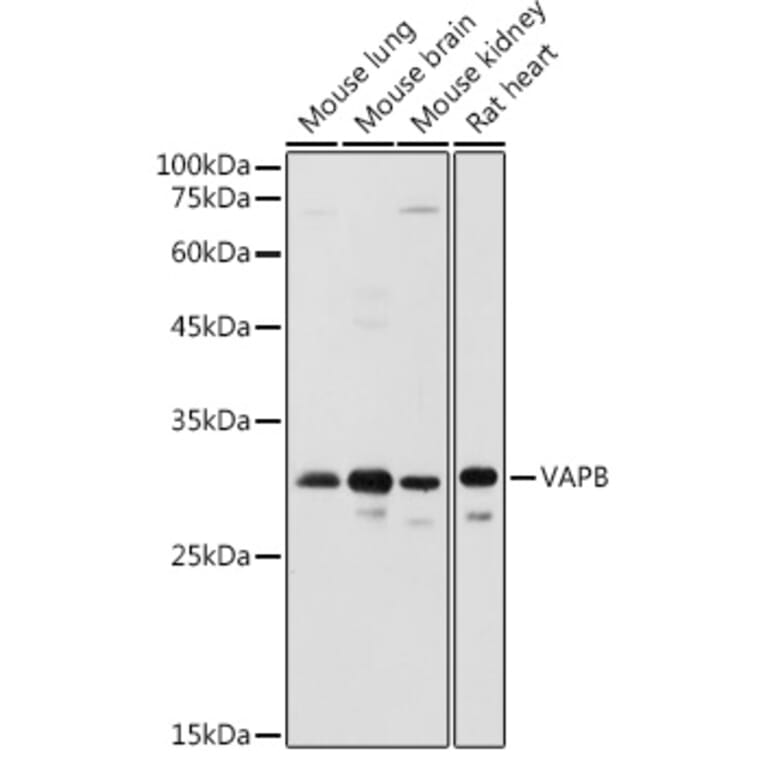 Western Blot - Anti-VAPB Antibody (A14703) - Antibodies.com
