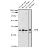 Western Blot - Anti-VAPB Antibody (A14703) - Antibodies.com
