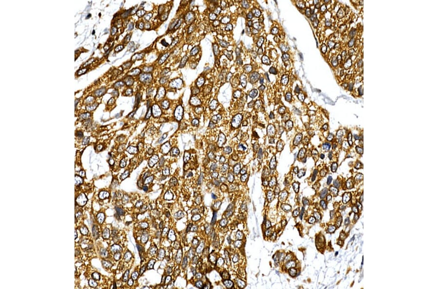 Immunohistochemistry - Anti-VAPB Antibody (A14703) - Antibodies.com