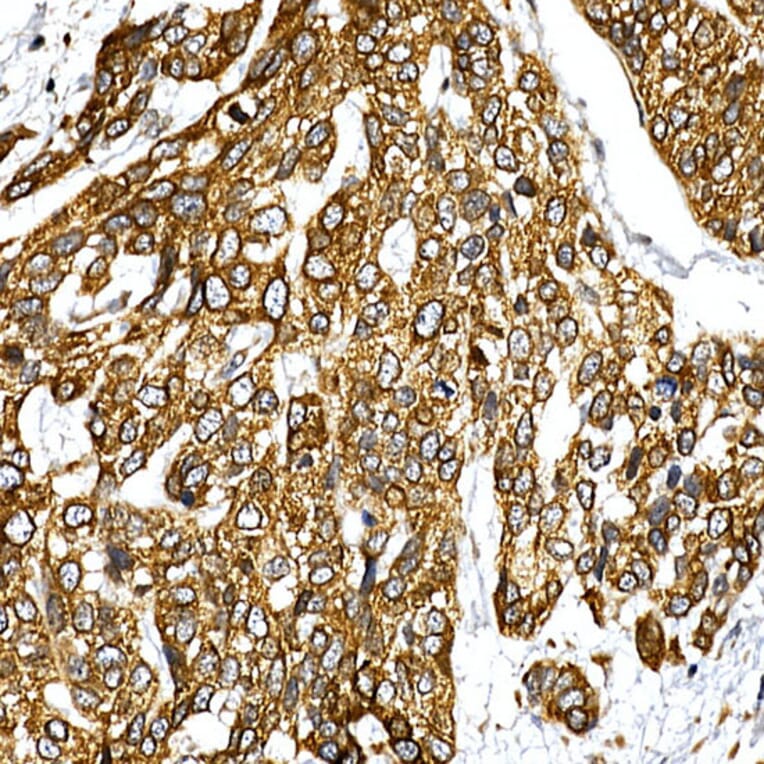 Immunohistochemistry - Anti-VAPB Antibody (A14703) - Antibodies.com