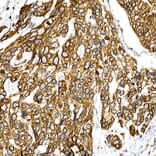 Immunohistochemistry - Anti-VAPB Antibody (A14703) - Antibodies.com