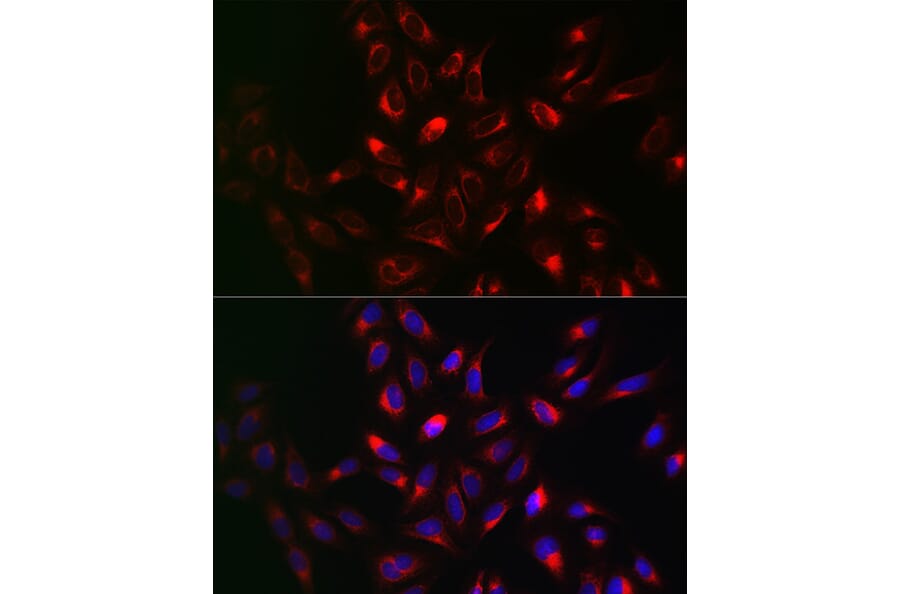 Immunofluorescence - Anti-VAPB Antibody (A14703) - Antibodies.com
