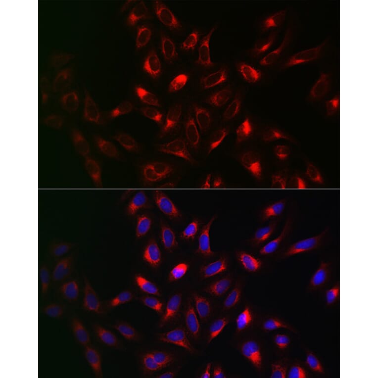 Immunofluorescence - Anti-VAPB Antibody (A14703) - Antibodies.com