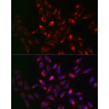 Immunofluorescence - Anti-VAPB Antibody (A14703) - Antibodies.com