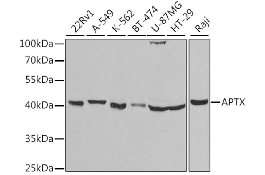 Western Blot - Anti-Aprataxin Antibody (A14704) - Antibodies.com