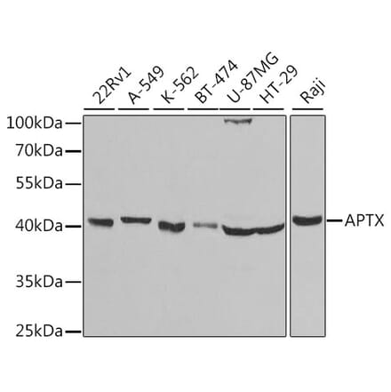 Western Blot - Anti-Aprataxin Antibody (A14704) - Antibodies.com