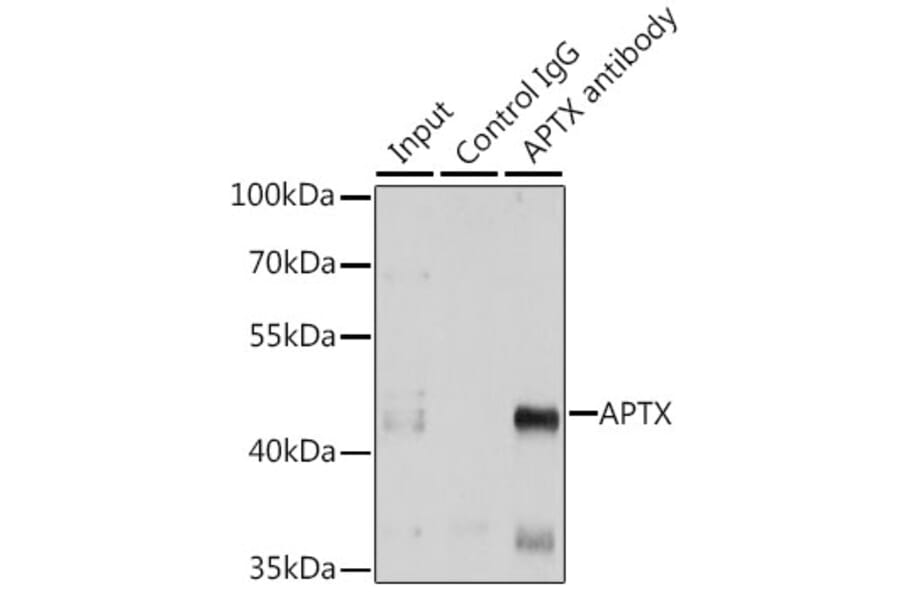 Western Blot - Anti-Aprataxin Antibody (A14704) - Antibodies.com