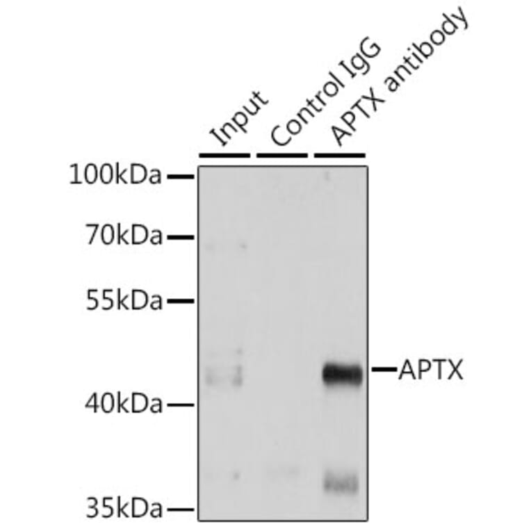 Western Blot - Anti-Aprataxin Antibody (A14704) - Antibodies.com