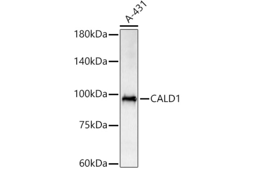 Western Blot - Anti-Caldesmon/CDM Antibody (A14705) - Antibodies.com
