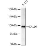 Western Blot - Anti-Caldesmon/CDM Antibody (A14705) - Antibodies.com
