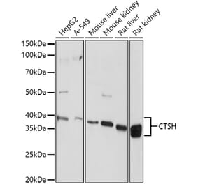 Western Blot - Anti-Cathepsin H Antibody (A14707) - Antibodies.com