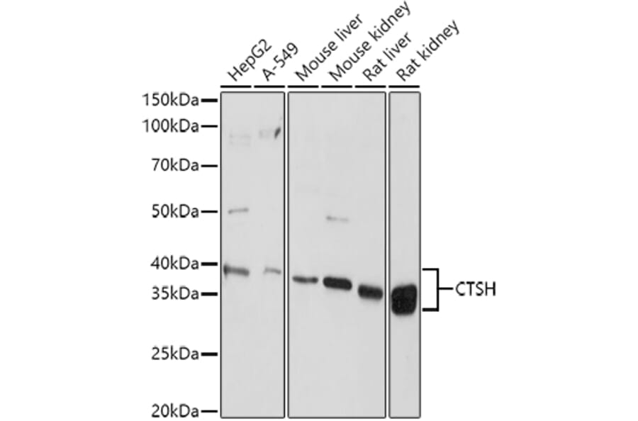 Western Blot - Anti-Cathepsin H Antibody (A14707) - Antibodies.com