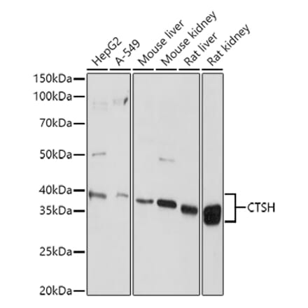 Western Blot - Anti-Cathepsin H Antibody (A14707) - Antibodies.com