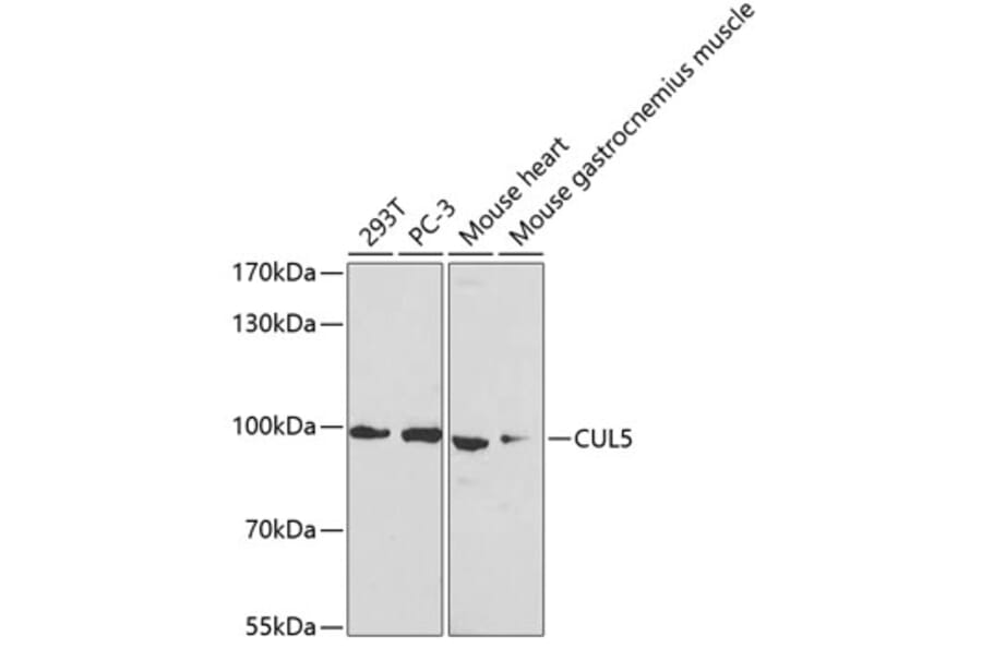 Western Blot - Anti-Cullin 5/CUL-5 Antibody (A14708) - Antibodies.com