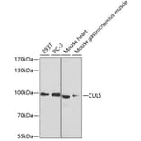 Western Blot - Anti-Cullin 5/CUL-5 Antibody (A14708) - Antibodies.com