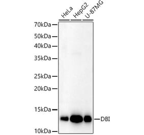 Western Blot - Anti-DBI Antibody (A14709) - Antibodies.com
