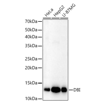 Western Blot - Anti-DBI Antibody (A14709) - Antibodies.com