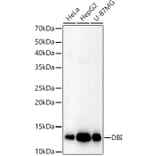 Western Blot - Anti-DBI Antibody (A14709) - Antibodies.com