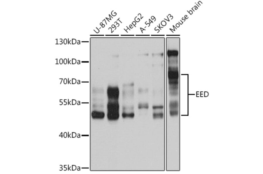 Western Blot - Anti-EED Antibody (A14710) - Antibodies.com