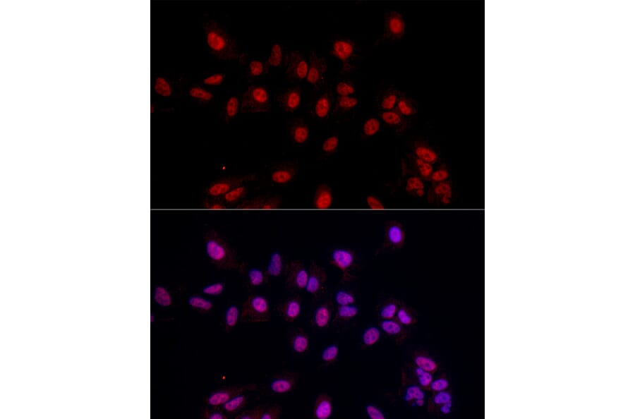 Immunofluorescence - Anti-EED Antibody (A14710) - Antibodies.com
