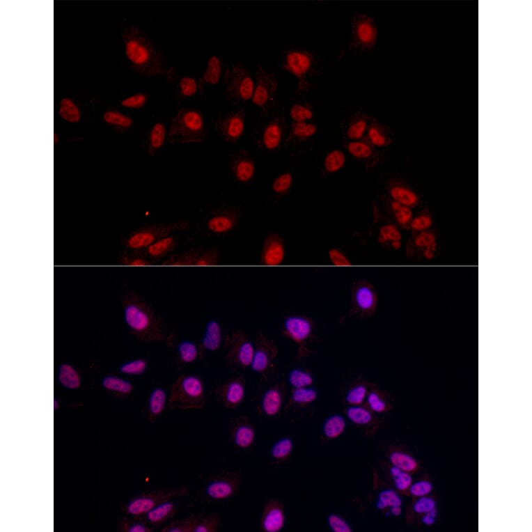Immunofluorescence - Anti-EED Antibody (A14710) - Antibodies.com