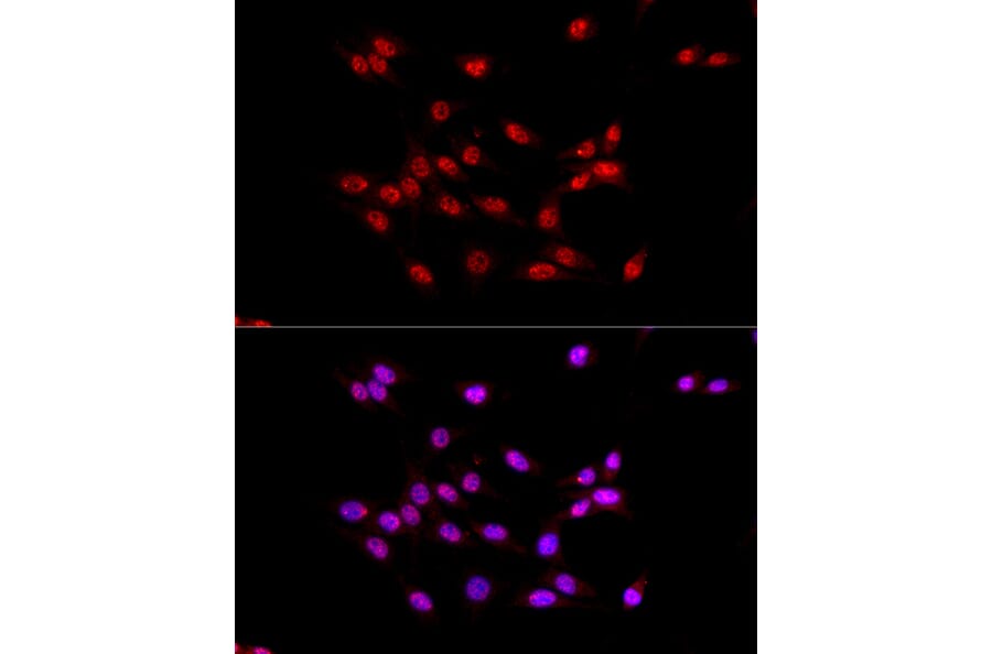 Immunofluorescence - Anti-EED Antibody (A14710) - Antibodies.com