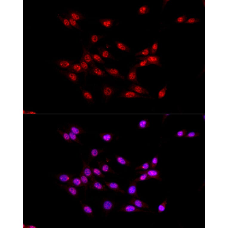 Immunofluorescence - Anti-EED Antibody (A14710) - Antibodies.com