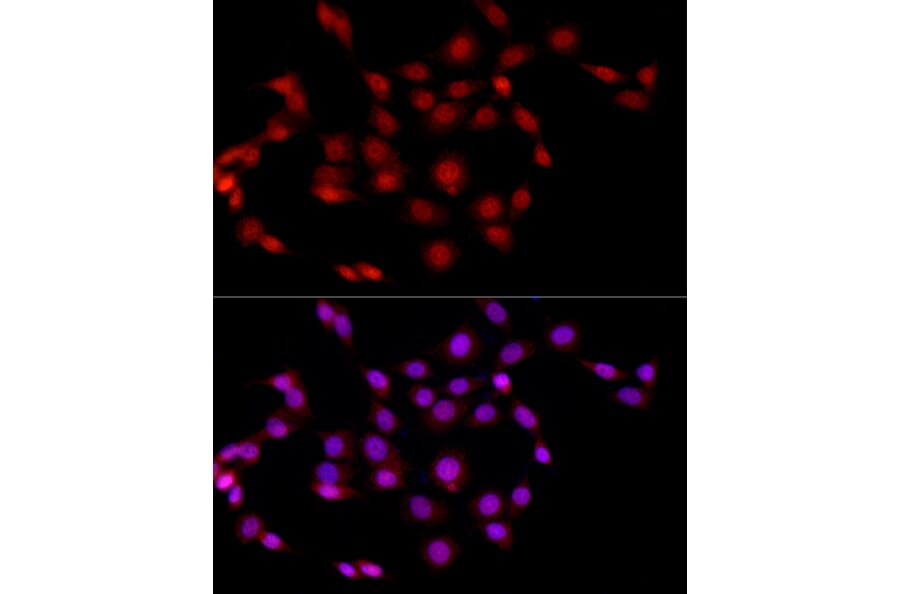 Immunofluorescence - Anti-EED Antibody (A14710) - Antibodies.com