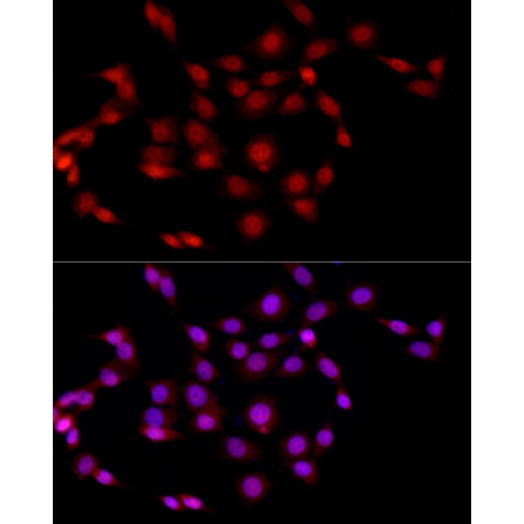 Immunofluorescence - Anti-EED Antibody (A14710) - Antibodies.com