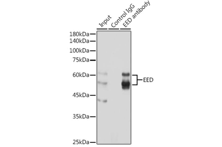 Western Blot - Anti-EED Antibody (A14710) - Antibodies.com