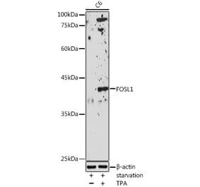 Western Blot - Anti-FRA1 Antibody (A14711) - Antibodies.com
