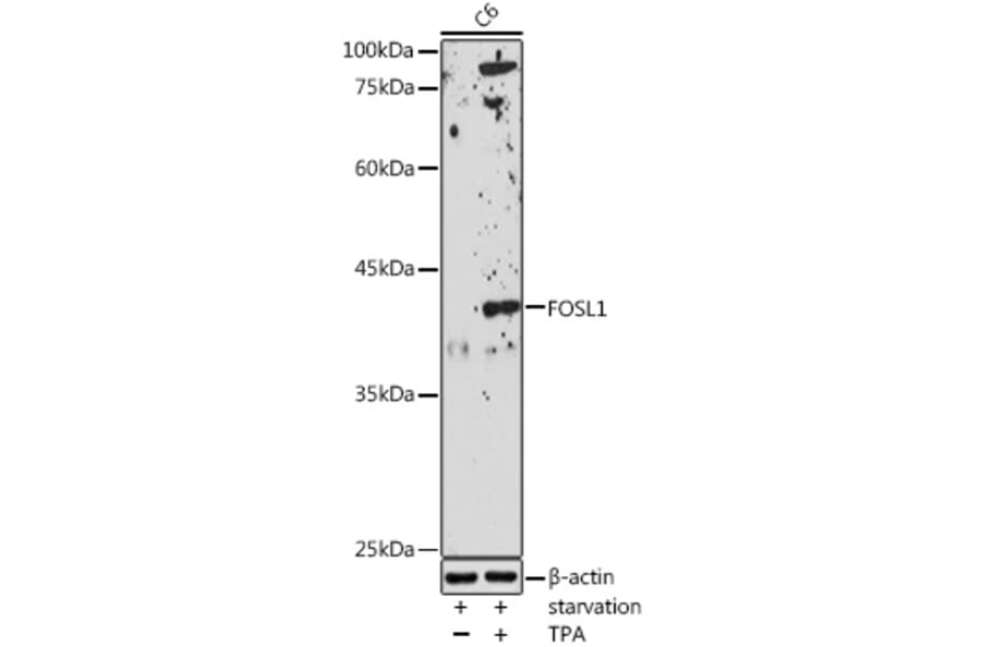 Western Blot - Anti-FRA1 Antibody (A14711) - Antibodies.com