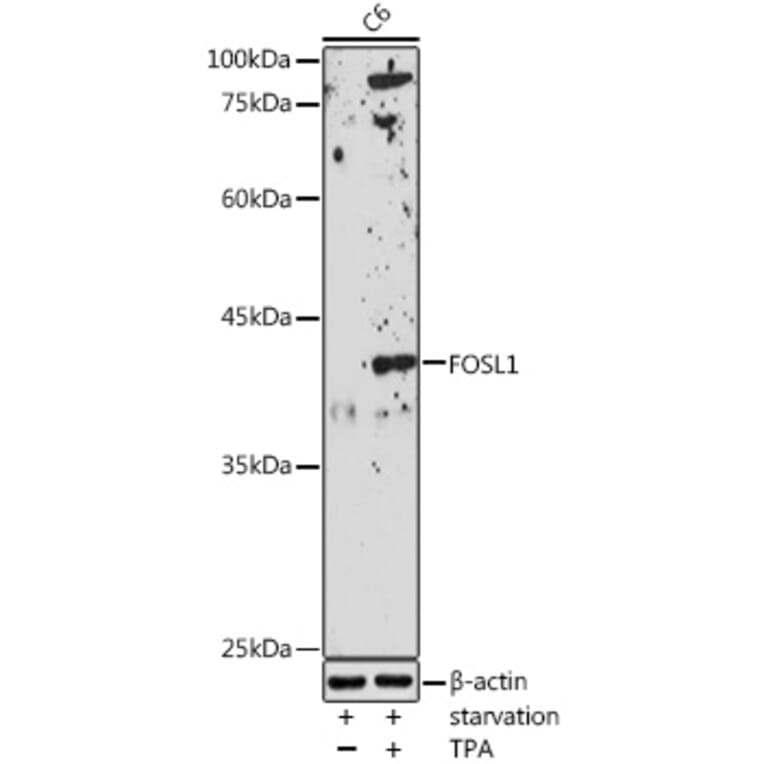 Western Blot - Anti-FRA1 Antibody (A14711) - Antibodies.com