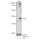 Western Blot - Anti-FRA1 Antibody (A14711) - Antibodies.com