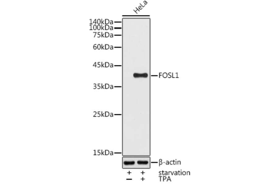 Western Blot - Anti-FRA1 Antibody (A14711) - Antibodies.com