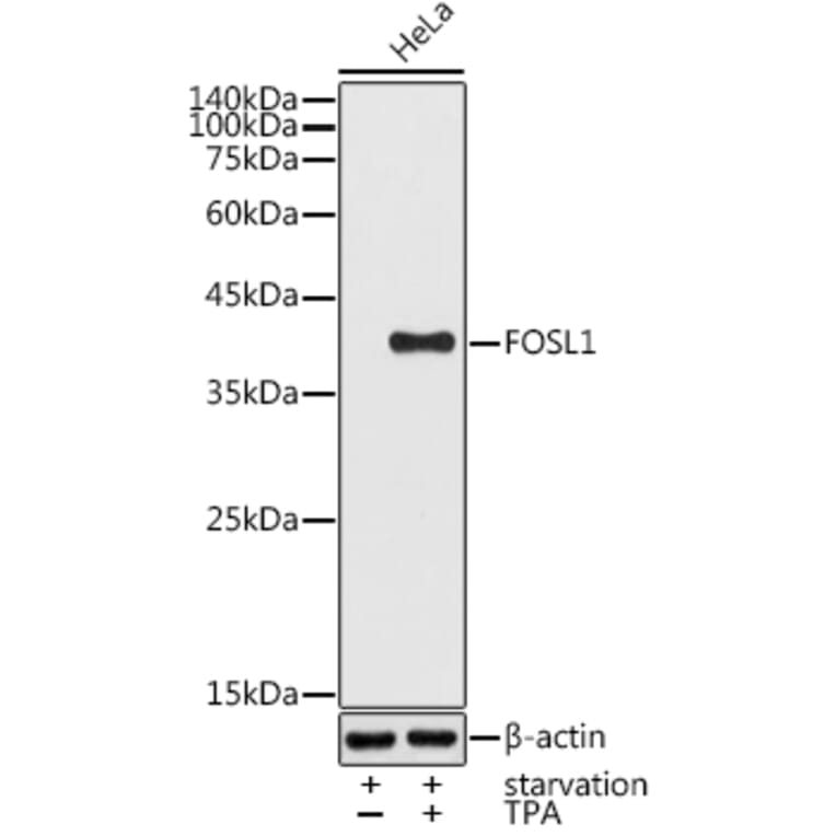 Western Blot - Anti-FRA1 Antibody (A14711) - Antibodies.com