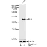 Western Blot - Anti-FRA1 Antibody (A14711) - Antibodies.com