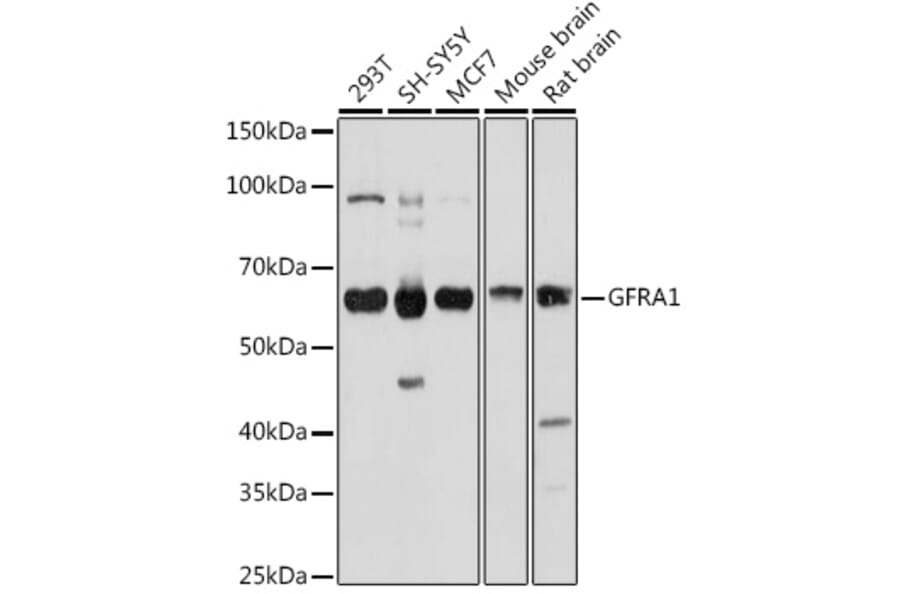 Western Blot - Anti-GDNF Receptor alpha 1/GFRA1 Antibody (A14712) - Antibodies.com