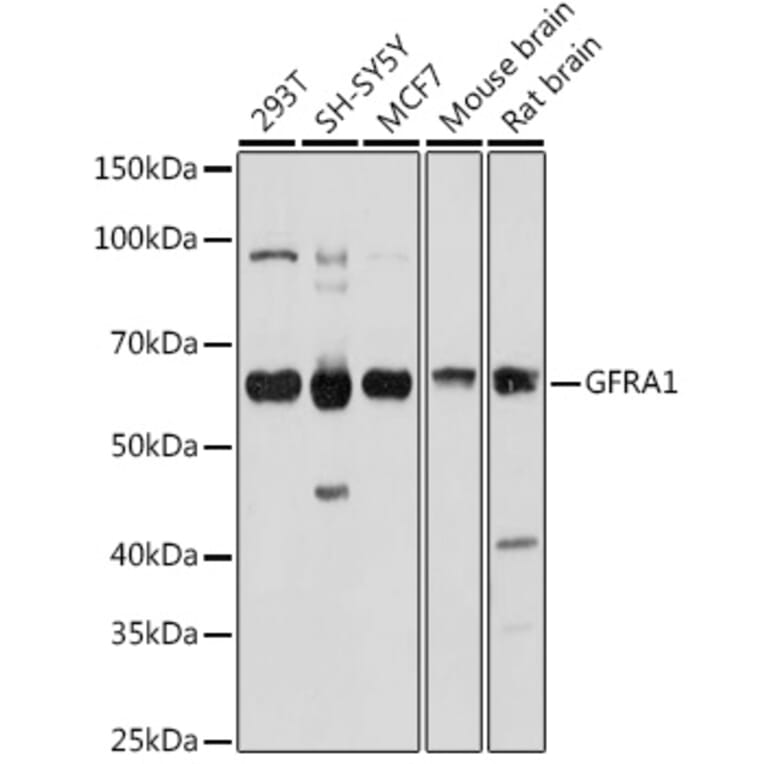 Western Blot - Anti-GDNF Receptor alpha 1/GFRA1 Antibody (A14712) - Antibodies.com