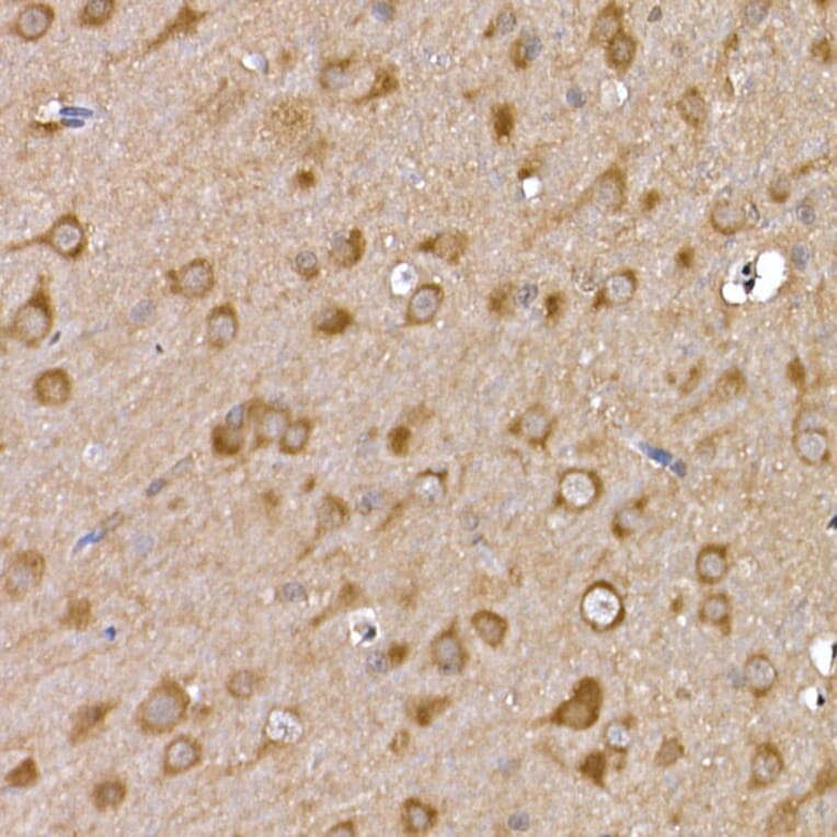Immunohistochemistry - Anti-GDNF Receptor alpha 1/GFRA1 Antibody (A14712) - Antibodies.com