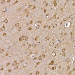 Immunohistochemistry - Anti-GDNF Receptor alpha 1/GFRA1 Antibody (A14712) - Antibodies.com