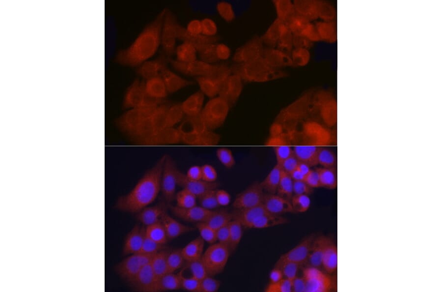 Immunofluorescence - Anti-GDNF Receptor alpha 1/GFRA1 Antibody (A14712) - Antibodies.com