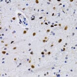 Immunohistochemistry - Anti-ID3 Antibody (A14713) - Antibodies.com