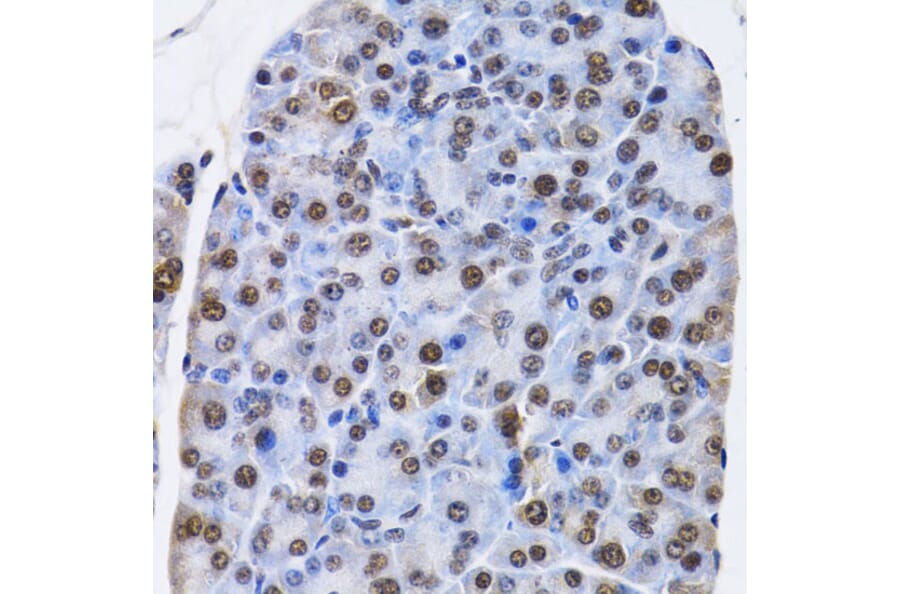 Immunohistochemistry - Anti-ID3 Antibody (A14713) - Antibodies.com