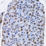 Immunohistochemistry - Anti-ID3 Antibody (A14713) - Antibodies.com