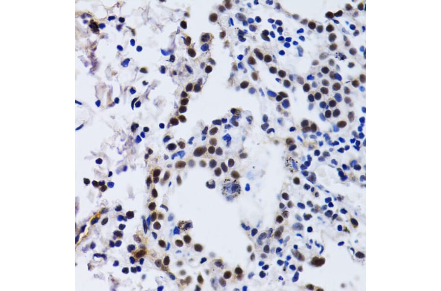 Immunohistochemistry - Anti-ID3 Antibody (A14713) - Antibodies.com