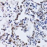 Immunohistochemistry - Anti-ID3 Antibody (A14713) - Antibodies.com