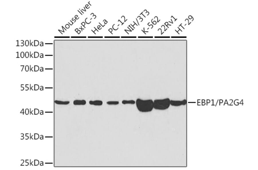 Western Blot - Anti-EBP1 Antibody (A14714) - Antibodies.com