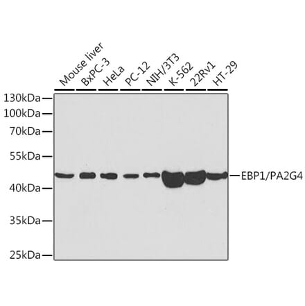 Western Blot - Anti-EBP1 Antibody (A14714) - Antibodies.com