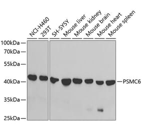 Western Blot - Anti-PSMC6 Antibody (A14715) - Antibodies.com